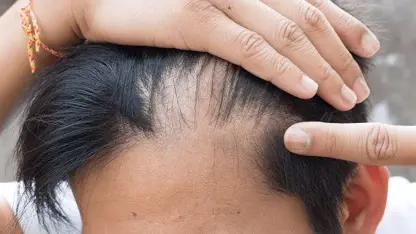 نحوه استفاده از روغن کرچک برای رشد مو در چند دقیقه