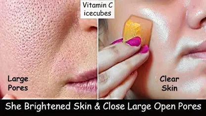ماسک صورت خانگی - تکه های یخ ویتامین c برای بستن منافذ