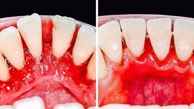 یادگیری 30 روش لازم مراقبت از دندان در چند دقیقه