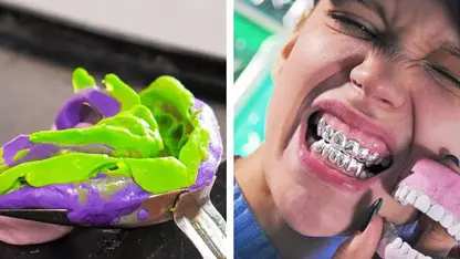 ترفندهای خلاقانه - تزئینات جالب روی دندان ها