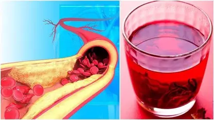 اشنایی با چای Hibiscus برای فشار خون بالا